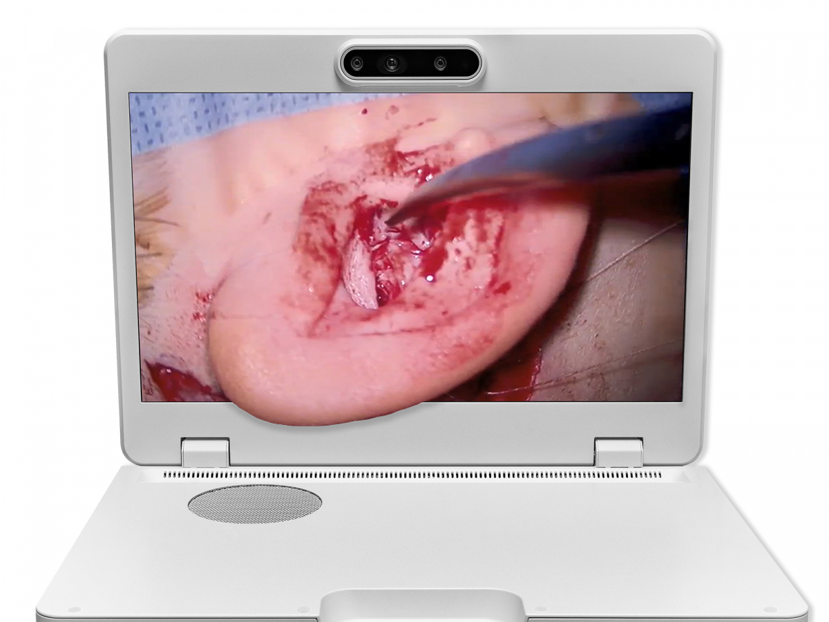 达擎之＂Heads-up 3D显微手术显示系统＂，整合4K裸眼3D显示及眼球追踪系统，具备快速追踪人眼移动位置功能，减轻医师长时间维持固定姿势的负担，让医师能有更宽广清晰的3D立体视野及更舒适的姿势来执行手术。